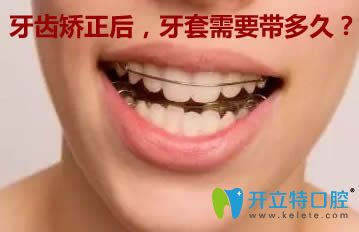 做完牙齒矯正后，保持器需要戴多長(zhǎng)時(shí)間？看完你就明白了