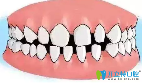 徐州博愛(ài)口腔牙頜畸形示意圖