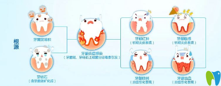 患有牙周病的人平時應(yīng)注意些什么？