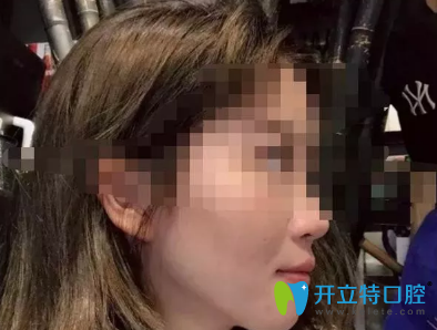 沒想到效果真的很好，我很感謝西安諾貝爾