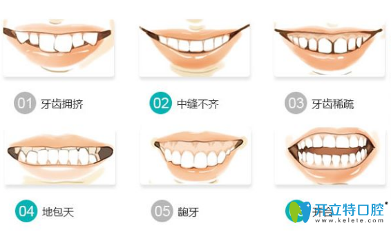 哪些情況牙齒需要矯正？牙齒矯正需要多少時間？