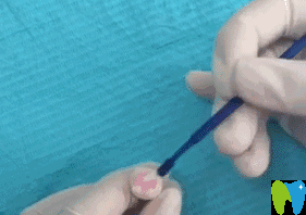 涂布封閉劑 涂布封閉劑