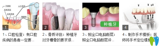 種植牙的手術過程