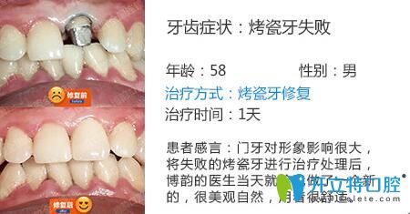 醫(yī)生姓名：周光正   醫(yī)生資質(zhì)：全科醫(yī)生  所屬機構(gòu)：南京博韻口腔  社會任職：  畢業(yè)院校：畢業(yè)于邢臺<!--<i data=20240703-sp></i>-->口腔醫(yī)學(xué)系  主診項目：牙列缺損修復(fù)、口腔種植、前牙美學(xué)修復(fù)、嵌體修復(fù)及復(fù)雜牙拔除。