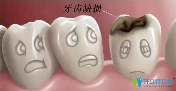 牙齒缺損修復(fù)方法哪種比較好?樂(lè)山英美口腔給出答案