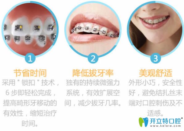 選擇青島諾德齒科黃主任做牙齒矯正的技術(shù)優(yōu)勢(shì)