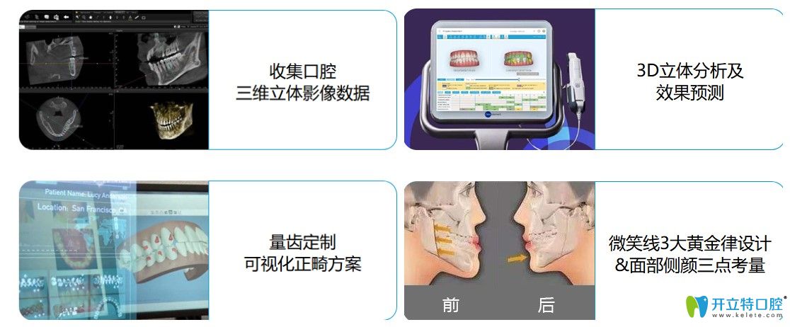 深圳弘和口腔的牙齒矯正的先進技術(shù)