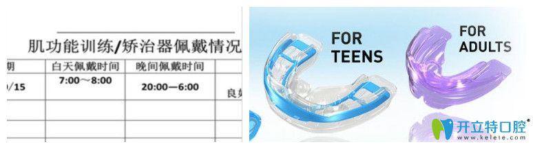 維樂(lè)口腔佩戴記錄表和兒童矯正器圖示