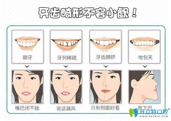 牙友自身看牙經(jīng)歷評(píng)測(cè)深圳友誠(chéng)齒科正畸價(jià)格及效果怎么樣