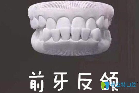 牙齒地包天能自我矯正嗎？牙齒反頜的矯正方法了解一下吧