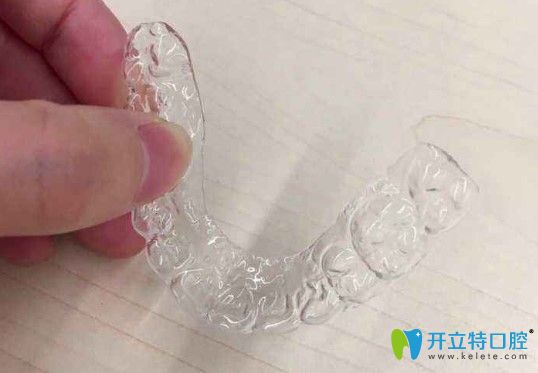 李瑛杰告訴你牙齒矯正后為什么會反彈