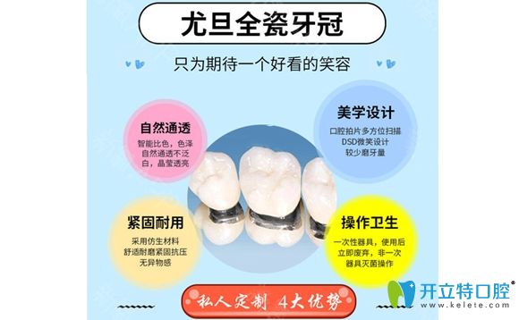 <!--<i data=20240703-sp></i>-->尤旦口腔全瓷牙優(yōu)勢介紹圖