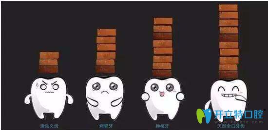 缺牙后的做哪些修復好 缺牙后的做哪些修復好