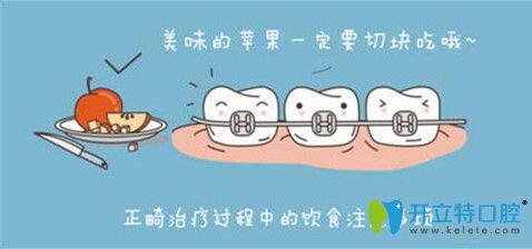 正畸過(guò)程中需注意飲食