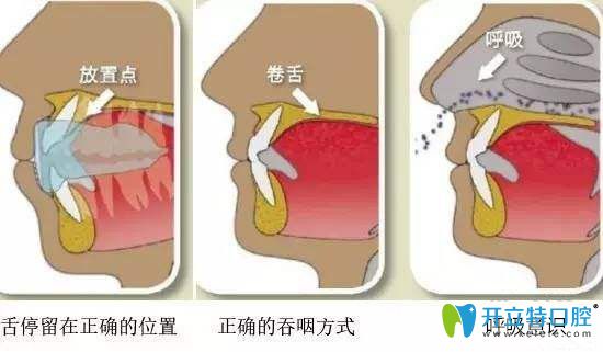 凱思口腔正確的口腔習慣