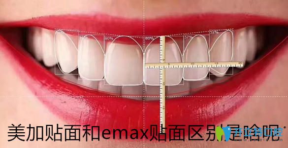 瓷貼面品牌千千萬(wàn)，帶你了解美加貼面和emax貼面區(qū)別是啥