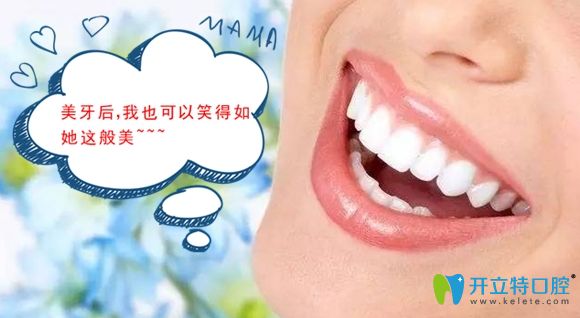 正畸配合美加超薄瓷貼面修復(fù)是我牙齒變美的小秘笈！
