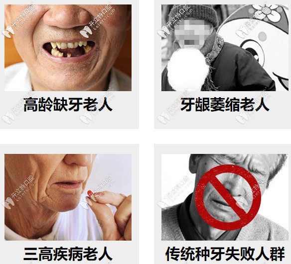 高齡缺牙、牙槽骨萎縮等都可以做種植牙
