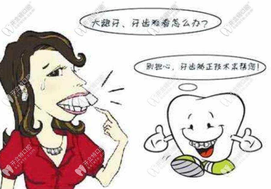 北京妹子說(shuō):因?yàn)楦F,選擇了價(jià)格居中的金屬自鎖托槽矯正