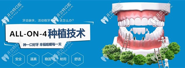 坐標(biāo)東莞，想做ALL-on-4即刻負(fù)重種植牙求推薦靠譜的醫(yī)院！