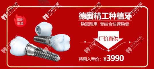 西安諾貝爾齒科德國(guó)種植牙活動(dòng)價(jià)格