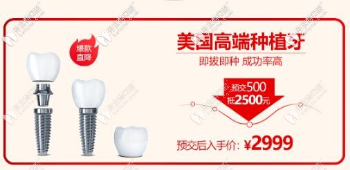 西安諾貝爾口腔門診部美國(guó)種植體價(jià)格