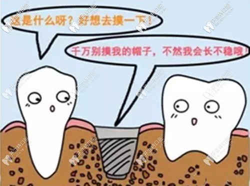 張少軍院長講解種植牙術(shù)后的一些常見注意事項(xiàng)