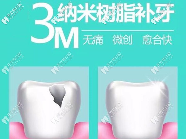 母親節(jié)西安美奧口腔樹(shù)脂補(bǔ)牙免費(fèi)