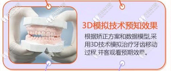 在?？诙c(diǎn)口腔做牙齒矯正前可先看效果