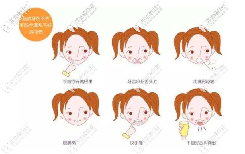 孩子的牙齒畸形可以進行矯正