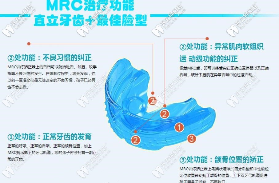 孩子早期牙齒畸形可以用MRC進行干預矯正