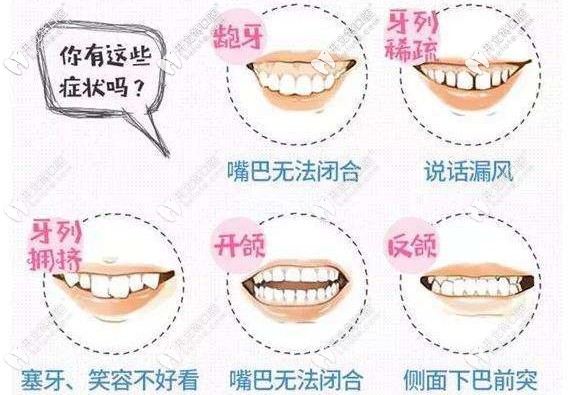 你的牙齒有這幾種情況嗎？