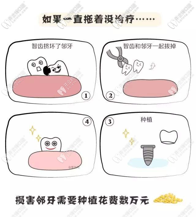 牙齒有問題一定要及時治療哦