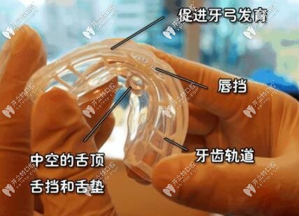 兒童功能矯治器
