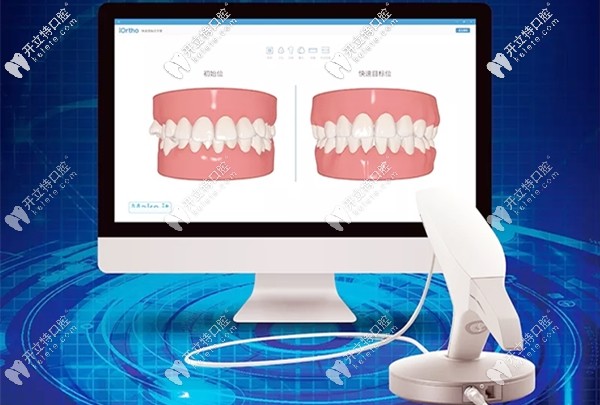時代天使3shape 3D口掃儀