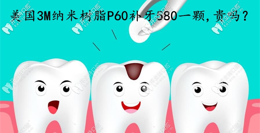 在煙臺做美國3MP60納米樹脂補(bǔ)牙580一顆，這費(fèi)用算貴嗎