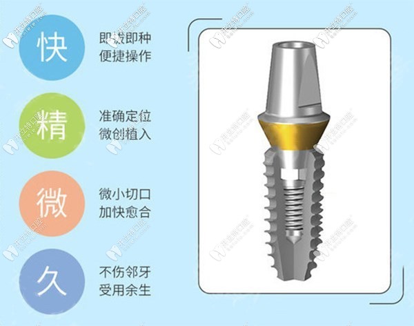 美國皓圣種植體2500元一顆靠譜嗎?中端檔次+質保5年+壽命20年