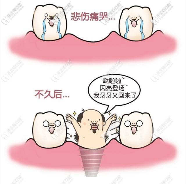 種植牙