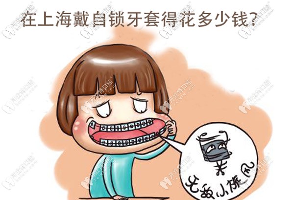目前在上海戴金屬自鎖牙套的價(jià)格大概是多少？