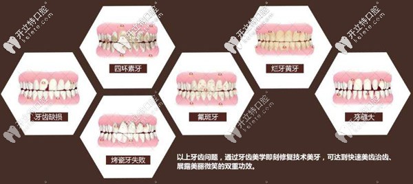需要做修復的牙齒情況