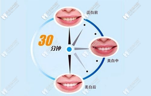 冷光美白原理