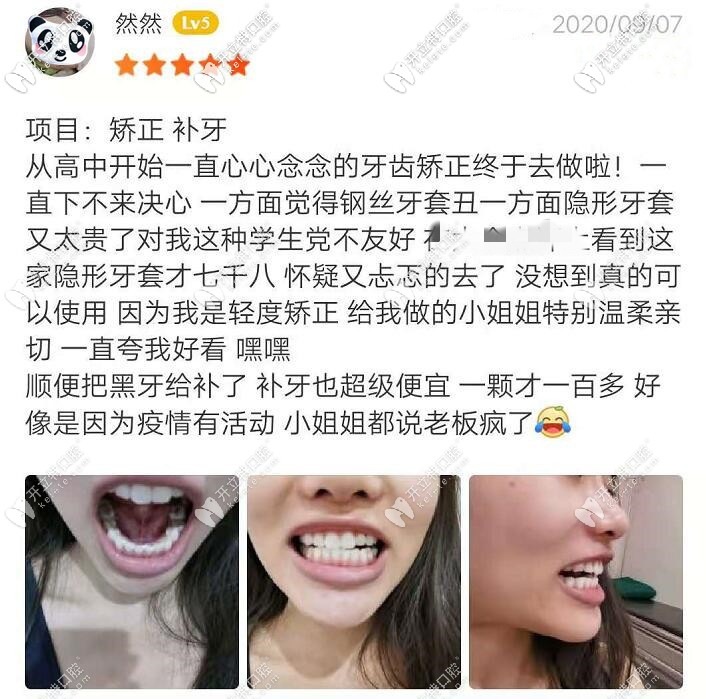 牙元素隱形牙套價(jià)格真便宜