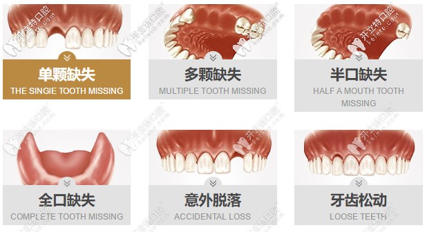 找這份合肥貝杰口腔做種植牙的價(jià)格表不容易，請(qǐng)珍惜~