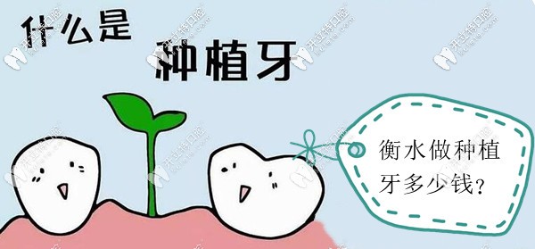 衡水種植牙價格是多少錢