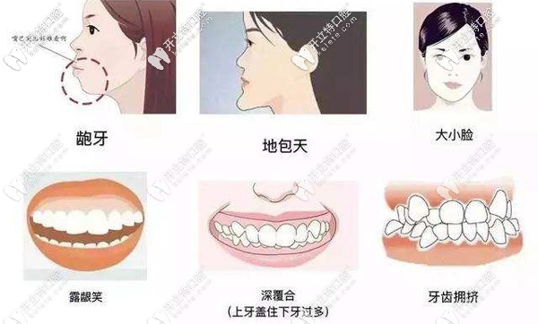 你是否有地包天、虎牙、齙牙、牙列不齊等牙齒問題