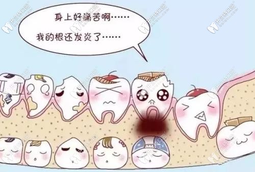 牙疼怎么辦，快來救救我！