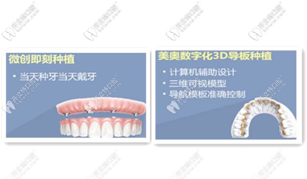 無錫美奧口腔醫(yī)院種植牙技術