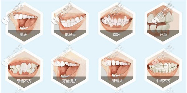 蕪湖矯正牙齒哪家好，這整牙正規(guī)的蕪湖牙科醫(yī)院排名得看