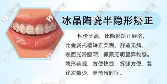 093-陶瓷透明自鎖優(yōu)勢_副本.jpg