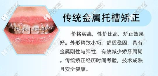 091-金屬矯正優(yōu)勢_副本.jpg